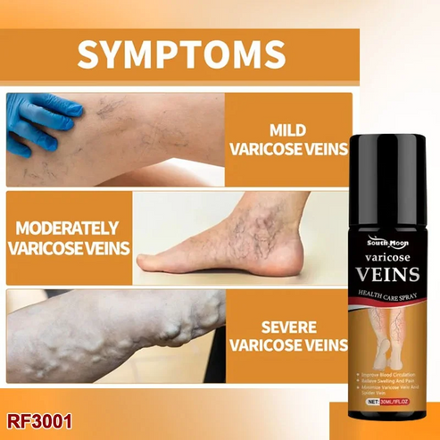 BEE VENOM VARICOSE VEINS RELIEF SPRAY (BUY 1 GET 1 FREE)(PACK OF 2)